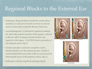 Braun local anesthetic ppt | PDF