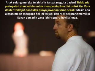 Anak sulung mereka telah lahir tanpa anggota badan! Tidak ada
peringatan atau waktu untuk mempersiapkan diri untuk itu. Para
dokter terkejut dan tidak punya jawaban sama sekali! Masih ada
alasan medis mengapa hal ini terjadi dan Nick sekarang memiliki
Kakak dan adik yang lahir seperti bayi lainnya.
 