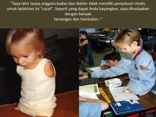 "Saya lahir tanpa anggota badan dan dokter tidak memiliki penjelasan medis
untuk kelahiran ini "cacat". Seperti yang dapat Anda bayangkan, saya dihadapkan
dengan banyak
tantangan dan hambatan. "
 