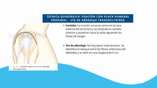 TÉCNICA QUIRÚRGICA: FIJACIÓN CON PLACA HUMERAL
PROXIMAL – VÍA DE ABORDAJE TRANSDELTOIDEA
Incisión: La incisión curva se centra en la cara
externa del acromion y se extiende en sentido
anterior y posterior hacia la axila siguiendo las
líneas de Langer.
Vía de abordaje: No hay plano internervioso. Se
identifica el tabique entre las fibras anteriores del
deltoides y se abre en una longitud de 6 cm.
 
