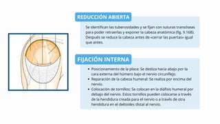 REDUCCIÓN ABIERTA
FIJACIÓN INTERNA
Se identifican las tuberosidades y se fijan con suturas transóseas
para poder retraerlas y exponer la cabeza anatómica (fig. 9.16B).
Después se reduce la cabeza antes de «cerrar las puertas» igual
que antes.
Posicionamiento de la placa: Se desliza hacia abajo por la
cara externa del húmero bajo el nervio circunflejo.
Reparación de la cabeza humeral: Se realiza por encima del
nervio.
Colocación de tornillos: Se colocan en la diáfisis humeral por
debajo del nervio. Estos tornillos pueden colocarse a través
de la hendidura creada para el nervio o a través de otra
hendidura en el deltoides distal al nervio.
 