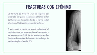 Fracturas con epónimo
La fractura de Holstein-Lewis se expone por
separado porque se localiza en el tercio distal
del húmero en la región donde el nervio radial
atraviesa el tabique intermuscular externo.
A este nivel, el nervio no puede adaptarse al
movimiento de los extremos óseos fracturados y
se lesiona en un 25% de los pacientes en las
fracturas humerales diafisarias, sin embargo la
incidencia global es del 10%.
 