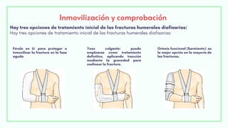 Inmovilización y comprobación
Hay tres opciones de tratamiento inicial de las fracturas humerales diafisarias:
Hay tres opciones de tratamiento inicial de las fracturas humerales diafisarias:
Férula en U: para proteger e
inmovilizar la fractura en la fase
aguda
Yeso colgante: puede
emplearse como tratamiento
definitivo, aplicando tracción
mediante la gravedad para
realinear la fractura.
Ortesis funcional (Sarmiento): es
la mejor opción en la mayoría de
las fracturas.
 