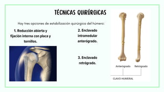 Técnicas quirúrgicas
Hay tres opciones de estabilización quirúrgica del húmero:
1. Reducción abierta y
fijación interna con placa y
tornillos.
2. Enclavado
intramedular
anterógrado.
3. Enclavado
retrógrado.
 