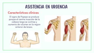 Asistencia en urgencia
Características clínicas
El signo de Popeye se produce
porque el vientre muscular de la
cabeza larga se contrae y
aumenta de volumen en la region
anterior de brazo.
 