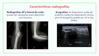 Características radiografías
Ecografías: el diagnostico suele ser
evidente mediante exploración clínica,
pero la ecografía puede ser util si hay
dudas.
Radiografías AP y lateral de codo:
puede ser necesarias para descartar
una fractura.
 