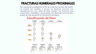 Son frecuentes y representan el 5% de todas las fracturas del adulto.
La mayoría son estables y ocurren en personas ancianas con
osteoporosis por una caída de baja energía. Las fracturas más
conminutas o inestables, o en pacientes con demanda funcional alta,
puede ser más apropiado el tratamiento quirúrgico.
Clasificación de Neer
FRACTURAS HUMERALES PROXIMALES
 