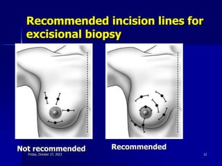 Recommended incision lines for
excisional biopsy
Not recommended Recommended
Friday, October 27, 2023 12
 