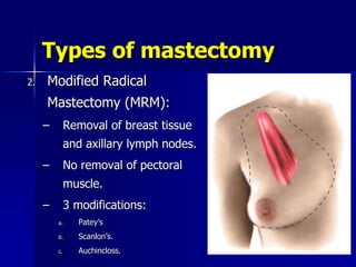 Types of mastectomy
2. Modified Radical
Mastectomy (MRM):
– Removal of breast tissue
and axillary lymph nodes.
– No removal of pectoral
muscle.
– 3 modifications:
a. Patey’s
b. Scanlon’s.
c. Auchincloss.
 