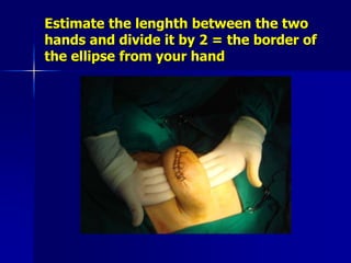 Estimate the lenghth between the two
hands and divide it by 2 = the border of
the ellipse from your hand
 