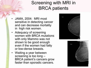 Screening with MRI in
BRCA patients
• JAMA, 2004: MRI most
sensitive in detecting cancer
and can decrease mortality
in hig...