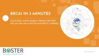 www.bosterbio.com
BRCA1 IN 3 MINUTES
Quick facts, control designs, Western Blot MW.
Info you can use to find the best BRCA1 antibody.
 