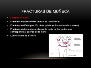 FRACTURAS DE MUÑECA
•   Fractura de Colle
•   Fracturas de Escafoides (hueso de la muñeca)
•   Fracturas de Falanges (En otras palabras, los dedos de la mano)
•   Fracturas de los metacarpianos (la parte de los dedos que
    corresponde al cuerpo de la mano)
•   Luxofractura de Bennett
 
