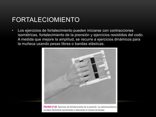 FORTALECIOMIENTO
•   Los ejercicios de fortalecimiento pueden iniciarse con contracciones
    isométricas, fortalecimiento de la prensión y ejercicios resistidos del codo.
    A medida que mejore la amplitud, se recurre a ejercicios dinámicos para
    la muñeca usando pesas libres o bandas elásticas.
 