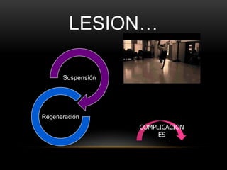 LESION…

      Suspensión




Regeneración
                   COMPLICACION
                        ES
 