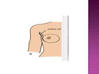 MOST IMPORTANT STRUCTURE OF THE PECTORAL REGION