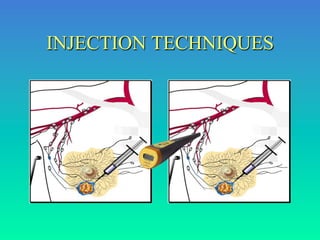 Cancer Test Injection Breast cancer screen | PDF