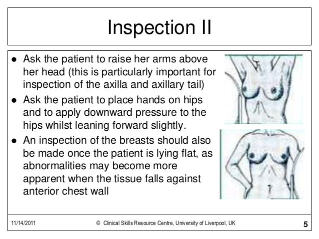 breast exam breast exam documentation