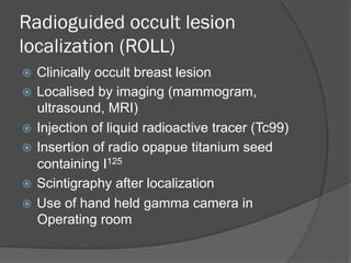 Breast imaging radioguided surgery m chan | PPT