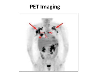 PET Imaging
 