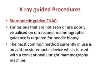 X ray guided Procedures
• Stereotactic guided FNAC:
• For lesions that are not seen or are poorly
visualised on ultrasound, mammographic
guidance is required for needle biopsy.
• The most common method currently in use is
an add-on stereotactic device which is used
with a conventional upright mammography
machine.
 