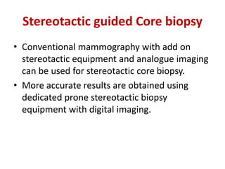 Stereotactic guided Core biopsy
• Conventional mammography with add on
stereotactic equipment and analogue imaging
can be used for stereotactic core biopsy.
• More accurate results are obtained using
dedicated prone stereotactic biopsy
equipment with digital imaging.
 