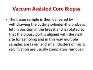 Vaccum Assisted Core Biopsy
• The tissue sample is then delivered by
withdrawing the cutting cylinder-the probe is
left in position in the breast and is rotated so
that the biopsy port is aligned with the next
site for sampling and in this way multiple
samples are taken and small clusters of micro
calcification are usually completely removed.
 