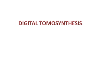 DIGITAL TOMOSYNTHESIS
 
