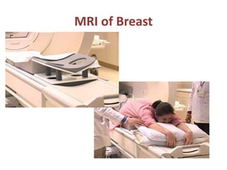 MRI of Breast
 