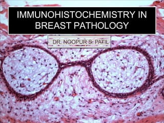 DR. NOOPUR S. PATIL
IMMUNOHISTOCHEMISTRY IN
BREAST PATHOLOGY
 