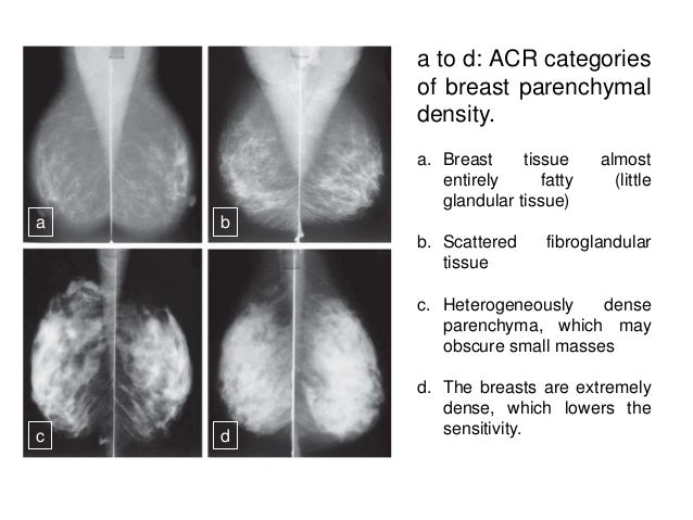 Breast Anatomy