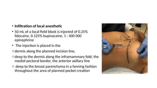 Inframamry Incision presention BREASTAUGmentaion final.pptx