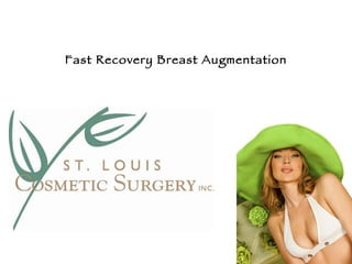 Steps to Breast Augmentation