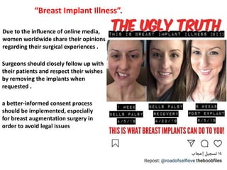 Breast augmentation complications