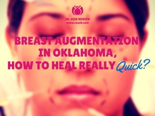 BREAST AUGMENTATION
IN OKLAHOMA,
HOW TO HEAL REALLYQuick?
DR. ERIK NUVEEN
www.csaok.com
 