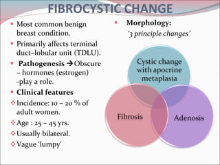FIBROCYSTIC CHANGE Most common benign breast condition.  Primarily affects terminal duct–lobular unit (TDLU). Pathogenesis   Obscure – hormones (estrogen) -play a role. Clinical features Incidence: 10 – 20 % of adult women. Age : 25 – 45 yrs. Usually bilateral. Vague ‘lumpy’ Morphology:  ‘ 3 principle changes’ 