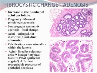 FIBROCYSTIC CHANGE - ADENOSIS Increase in the number of acini per lobule. Pregnancy   Normal physiologic adenosis.  Nonpregnant women    adenosis - focal change.  Acini – enlarged,not distorted  (blunt-duct adenosis). Calcifications – occasionally - within the lumens.  Acini - lined by columnar cells    benign / atypical features ( “flat epithelial atypia”)    Earliest recognizable precursor of epithelial neoplasia 