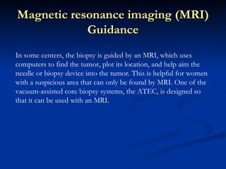 Breast biopsy | PPT