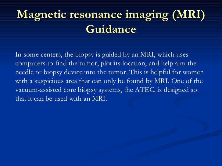 What will an MRI-guided biopsy be like?