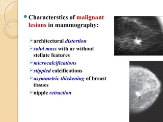 Characterstics of malignant
lesions in mammography:
architectural distortion
solid mass with or without
stellate features
microcalcifications
stippled calcifications
asymmetric thickening of breast
tissues
nipple retraction
 