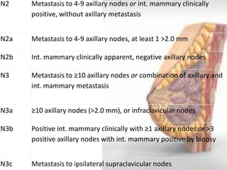 N2 
Metastasis to 4-9 axillary nodes or int. mammary clinically positive, without axillary metastasis 
N2a 
Metastasis to 4-9 axillary nodes, at least 1 >2.0 mm 
N2b 
Int. mammary clinically apparent, negative axillary nodes 
N3 
Metastasis to ≥10 axillary nodes or combination of axillary and int. mammary metastasis 
N3a 
≥10 axillary nodes (>2.0 mm), or infraclavicular nodes 
N3b 
Positive int. mammary clinically with ≥1 axillary nodes or >3 positive axillary nodes with int. mammary positive by biopsy 
N3c 
Metastasis to ipsilateral supraclavicular nodes  