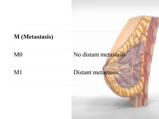 M (Metastasis) 
M0 
No distant metastasis 
M1 
Distant metastasis  