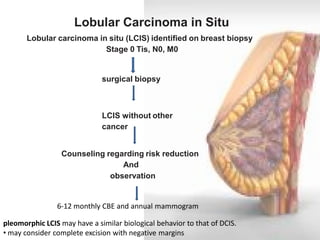 Lobular Carcinoma in Situ 
Lobular carcinoma in situ (LCIS) identified on breast biopsy 
Stage 0 Tis, N0, M0 
surgical biopsy 
LCIS without other cancer 
Counseling regarding risk reduction 
And 
observation 
6-12 monthly CBE and annual mammogram 
pleomorphic LCIS may have a similar biological behavior to that of DCIS. 
• may consider complete excision with negative margins  