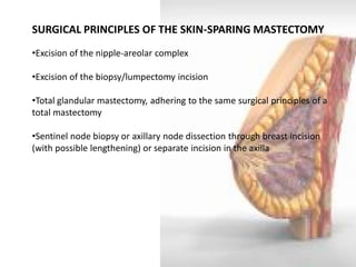 SURGICAL PRINCIPLES OF THE SKIN-SPARING MASTECTOMY 
•Excision of the nipple-areolar complex 
•Excision of the biopsy/lumpectomy incision 
•Total glandular mastectomy, adhering to the same surgical principles of a total mastectomy 
•Sentinel node biopsy or axillary node dissection through breast incision (with possible lengthening) or separate incision in the axilla  
