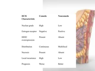 DCIS Characteristic 
Comedo 
Noncomedo 
Nuclear grade 
High 
Low 
Estrogen receptor 
Negative 
Positive 
HER2 overexpression 
Present 
Absent 
Distribution 
Continuous 
Multifocal 
Necrosis 
Present 
Absent 
Local recurrence 
High 
Low 
Prognosis 
Worse 
Better  