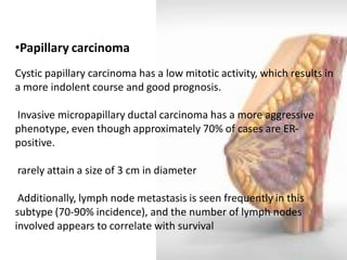 •Papillary carcinoma Cystic papillary carcinoma has a low mitotic activity, which results in a more indolent course and good prognosis. Invasive micropapillary ductal carcinoma has a more aggressive phenotype, even though approximately 70% of cases are ER- positive. rarely attain a size of 3 cm in diameter Additionally, lymph node metastasis is seen frequently in this subtype (70-90% incidence), and the number of lymph nodes involved appears to correlate with survival  