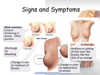 Signs and Symptoms 
Most common: lump or thickening in breast. Often painless 
Change in color or appearance of areola 
Redness or pitting of skin over the breast, like the skin of an orange 
Discharge or bleeding 
Change in size or contours of breast  