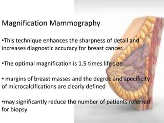 Magnification Mammography 
•This technique enhances the sharpness of detail and increases diagnostic accuracy for breast cancer. 
•The optimal magnification is 1.5 times life size 
• margins of breast masses and the degree and specificity of microcalcifications are clearly defined 
•may significantly reduce the number of patients referred for biopsy  