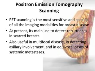 Positron Emission Tomography Scanning 
•PET scanning is the most sensitive and specific of all the imaging modalities for breast disease 
•At present, its main use to detect recurrences in scarred breasts 
•Also useful in multifocal disease, in detecting axillary involvement, and in equivocal cases of systemic metastases. 
 