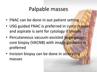 Palpable masses 
•FNAC can be done in out patient setting 
•USG guided FNAC is preferred in cystic masses and aspirate is sent for cytology if bloody 
•Percutaneous vacuum-assisted large-gauge core biopsy (VACNB) with image guidance is preferred 
•Incision biopsy can be done in ulcerating masses  